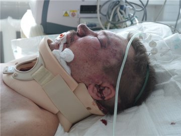 Затримали хлопця, який проламав череп чоловіку в Нововолинську