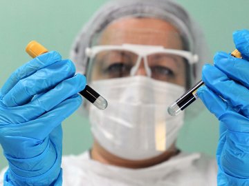 В Україні за добу – більше півтори тисячі нових випадків коронавірусу 