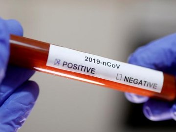 Українці зможуть зробити тест на коронавірус за 15 хвилин