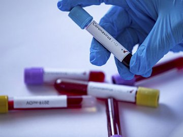 Ранок 26 вересня: в Україні – 3 833 нових випадки коронавірусу, на Волині – знову антирекорд