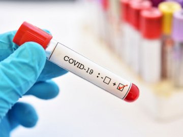 Серед жителів Володимира – 8 нововиявлених інфікованих коронавірусом