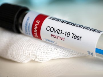 У 8 волинян повторно виявили коронавірус