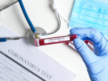 24 нових та 2 летальних випадки: ситуація з коронавірусом на Волині за минулу добу