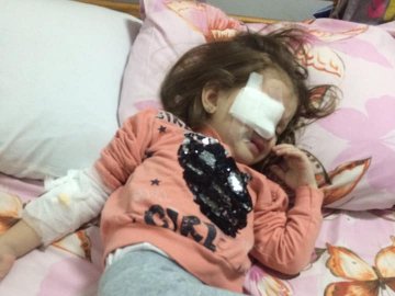 Під час бійки в дитсадку дівчинку вдарили олівцем в око. ФОТО