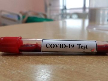 Одна смерть і 203 нових випадки: яка ситуація з коронавірусом на Волині станом на 21 жовтня