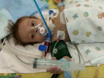 Малюку з Волині провели трансплантацію печінки, однак бракує коштів на реабілітацію