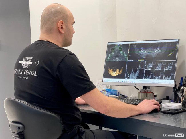 Видалення зубів мудрості: луцький стоматолог розповів, що варто знати кожному пацієнту