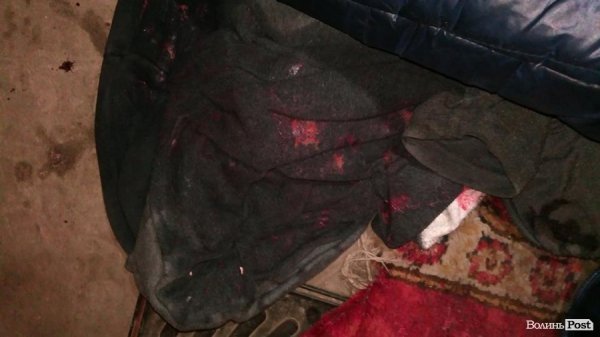 «Нічна варта»: стриптиз у поліції, закривавлений чоловік та бенефіс п'яних водіїв