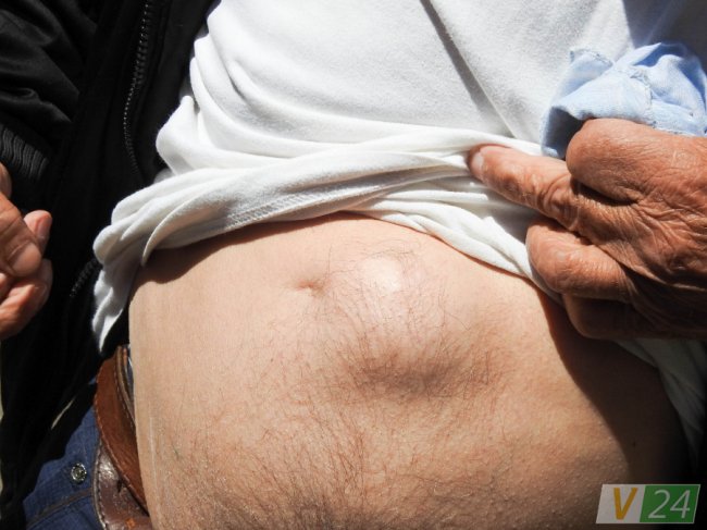 Добивали багнетами: трагедія ромів на Волині