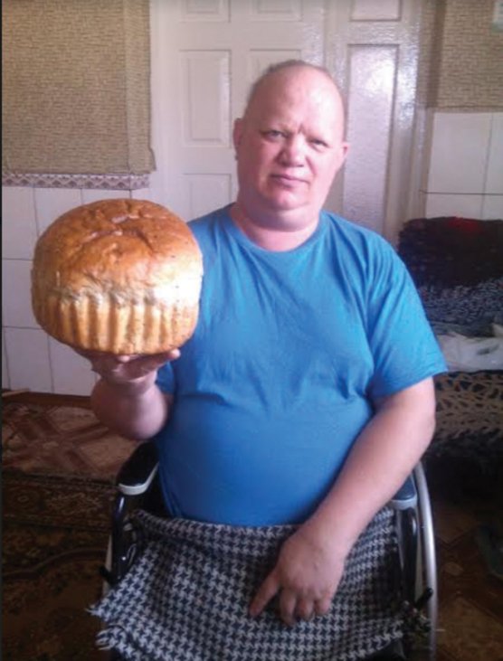 Як волинянин, що втратив обидві ноги на заробітках, почав нове життя