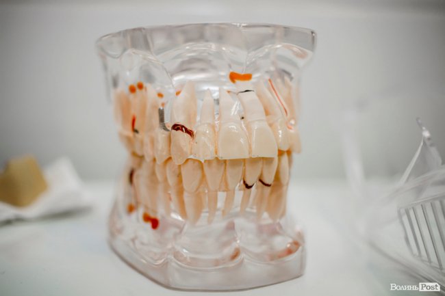 Талановиті лікарі, нова техніка та сучасні підходи до лікування: клініка «Віта Дент» руйнує «страшилки» про стоматологію*