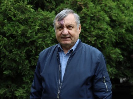 «Ти п'єш – і я почну». Психолог з Луцька розповів, що таке співзалежність при алкоголізмі і чим вона загрожує