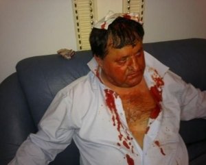 "Кастет", що розбив голову бютівцю у парламенті - це волинський регіонал Горбатюк?