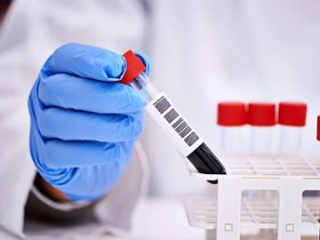 Ранок 22 червня: в Україні – 681 новий випадок коронавірусу, на Волині –  70