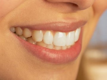 Вчені пропонують покривати зуби штучною плівкою-емаллю 
