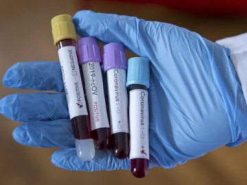 Ранок 17 червня: в Україні – 758 нових випадків коронавірусу, з них на Волині – 55