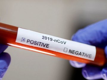 У Луцьку – 9 нових випадків коронавірусу
