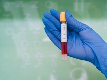 Повідомили кількість заражених COVID-19, виявлених в Україні за добу