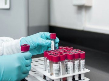 Ранок 9 липня: в Україні – 810 нових випадків коронавірусу, з них на Волині – 50