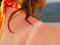 Сонячний опік: луцька лікарка розповіла, що робити та як відновити шкіру 