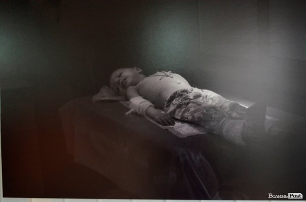 У Луцьку - виставка світлин про рак у дітей. ФОТО