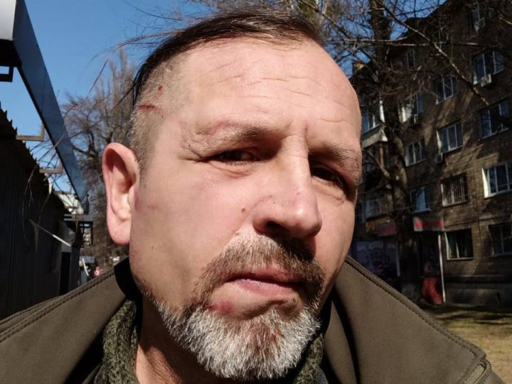 Колишнього політв’язня Кремля Балуха побили в київському ТЦК. Що відомо?