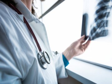 COVID-19 та туберкульоз: волинянам розповіли, як не сплутати хвороби