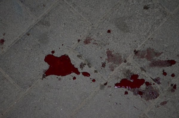 У Луцьку «Правий сектор» впіймав наркомана-збоченця. ФОТО