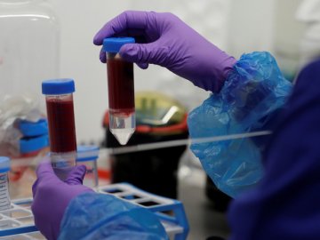 Яка ситуація з коронавірусом у Любешівському районі станом на 25 червня