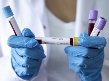 Повідомили статистику щодо COVID-19 в Україні за останню добу