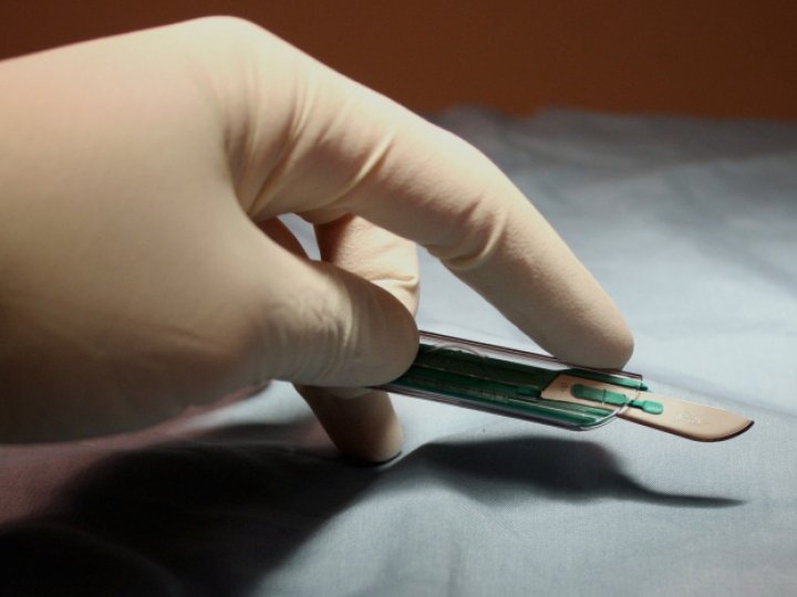 Хірургічні скальпелі в сучасній медицині: точність розрізу та безпека операцій