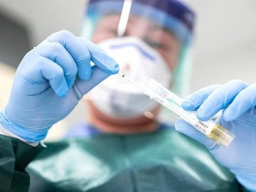 В Україні розробляють ПЛР-тести для визначення п’яти хвороб