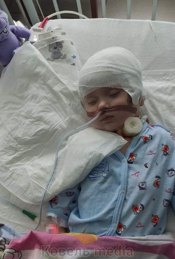 Півторарічний хлопчик з Волині, який отримав важкі травми при падінні, потребує допомоги на лікування