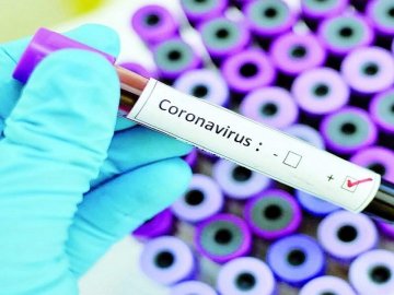 У жінки з Горохівського району підтвердили коронавірус