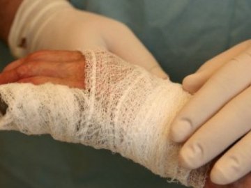 На Волині дитина отримала страшні опіки від котла