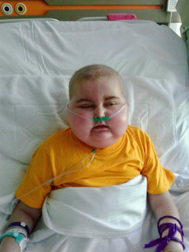 Турецька клініка погодилась оперувати Настю Абрамчук: потрібні кошти