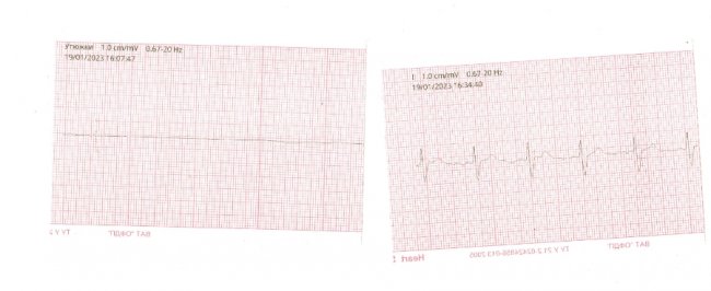 На Волині медики врятували життя людині після зупинки серця