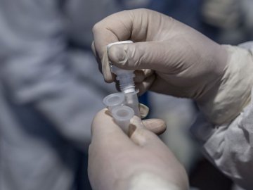 Пояснили, чому не треба сподіватися на антитіла після COVID і перевіряти їх