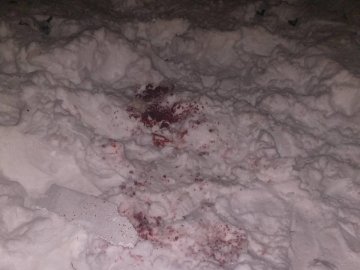 Понівечене обличчя та відірвана кисть: чоловік постраждав під час запуску феєрверків. ФОТО