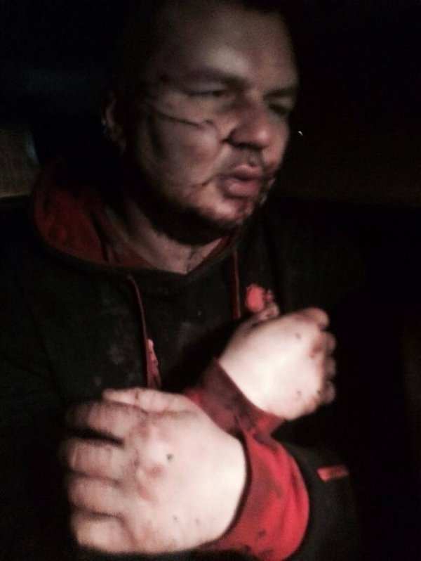 Лідер Автомайдану розповів, як його катували. ВІДЕО