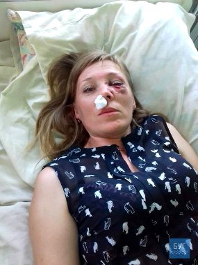 «Аліментів захотіла?» - на Волині чоловік побив колишню дружину. ФОТО. ВІДЕО. 18+