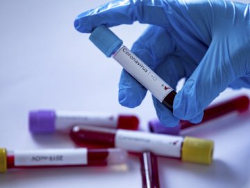 Коронавірус на Любешівщині: ситуація у розрізі населених пунктів району