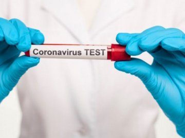 Кабмін змінив правила в'їзду в Україну: тепер потрібен обов'язковий ПЛР-тест на коронавірус 