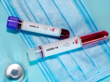 Коронавірус в Україні: які показники зафіксували за минулу добу