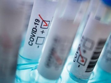 За останню добу на Волині зафіксували 2 смерті та 125 нових випадків коронавірусу