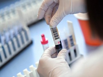 За добу на Волині – лише 1 новий випадок коронавірусу