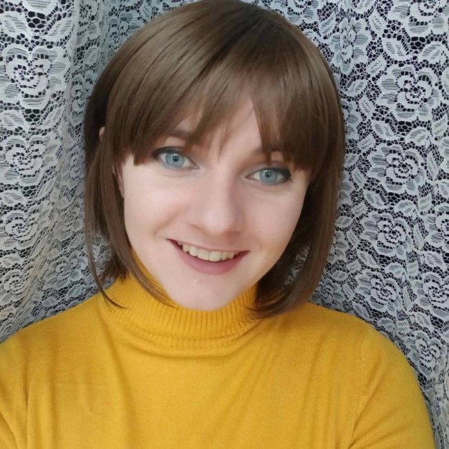 «Я втомилася ховати свою хворобу та змогла полюбити себе»: історія дівчини з Волині, яка з дитинства має важку недугу  