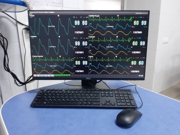 Волинська лікарня отримала техніки на понад 65 тисяч євро