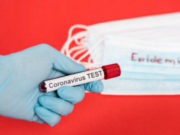 Коронавірус в Україні: повідомили про ситуацію за минулу добу