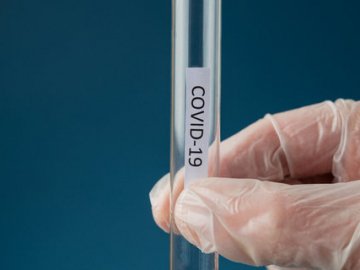 Повідомили статистику щодо коронавірусу в Україні за добу 